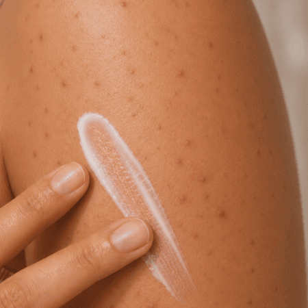 Oily & Acne Prone