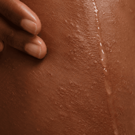 Sensitive & Eczema Prone